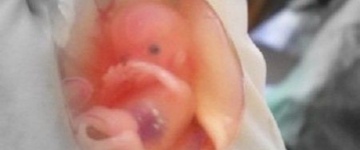 Фото: Когда в плодном яйце появляется эмбрион